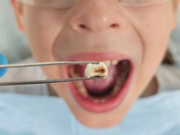 Best Tooth Infection Emergency Dentist  in Topton, PA