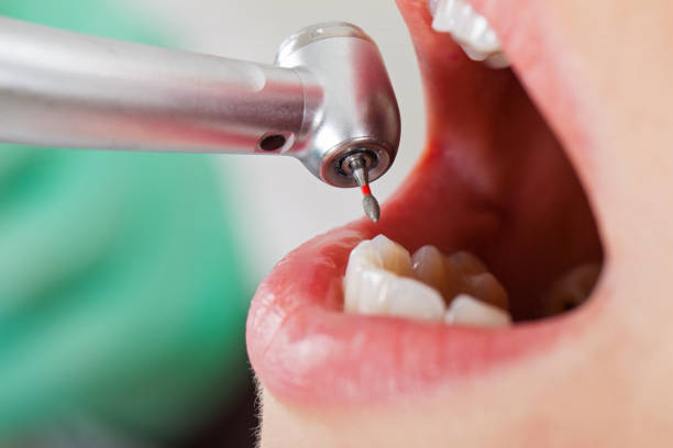 Best Broken Tooth Emergency  in Topton, PA